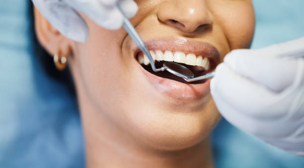 Best Emergency Wisdom Teeth Removal in Lakin, KS