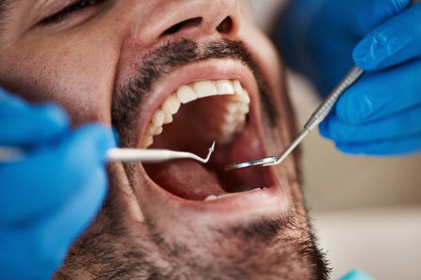 Best Emergency Treatment for Dental Infections or Abscesses in Lakin, KS